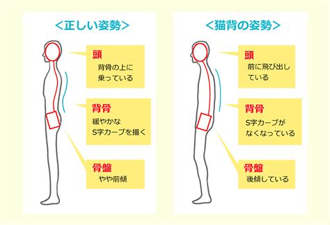 猫背矯正 西宮市 西宮駅で腰痛に強い整体なら はやし整体院