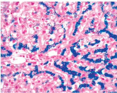 Pathology Exam Flashcards Quizlet