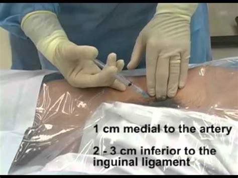 PLACEMENT OF A FEMORAL VENOUS CATHETER | FunnyCat.TV