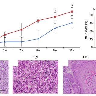 Comparison Of Tumor Growth Speed And Estimation Of The MIB 1 Indices