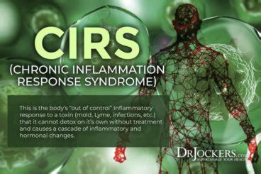 CIRS: Causes, Symptoms and Solutions - DrJockers.com