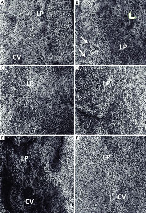 Representative Scanning Electron Micrographs Of Rat Liver 300 A Download Scientific