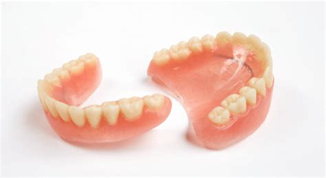 Tooth Supported Overdenture - Atlas Dental Toronto