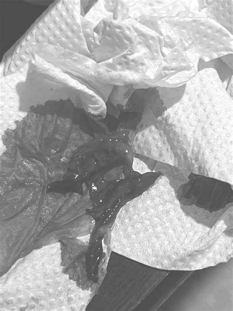 did i miscarry? or is it just a normal clot in my menstruation? : r