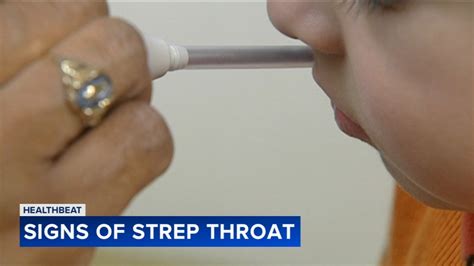 Strep throat: What you need to know as fall approaches - ABC7 Chicago