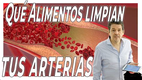 Estos Son Los Mejores Alimentos Para Limpiar Tus Arterias Youtube