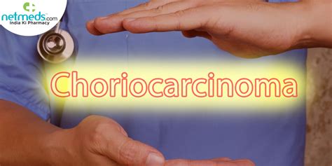 Choriocarcinoma Causes Symptoms And Treatment