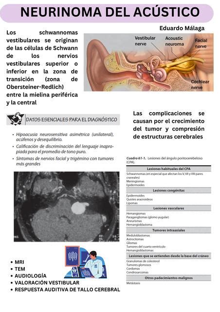 Neurinoma del Acústico EDUARDO MÁLAGA uDocz