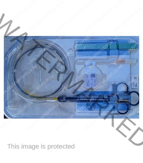 peg kit feeding tube  sizes tims nutrition consultancy
