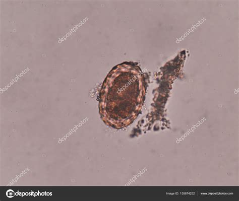 Ascaris Lumbricoides Egg In Stool Exam Stock Photo By Toeytoey