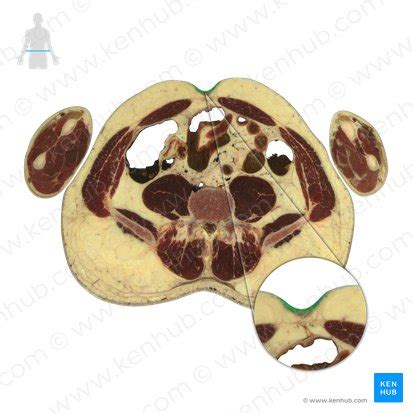 Umbilicus: Anatomy and function | Kenhub