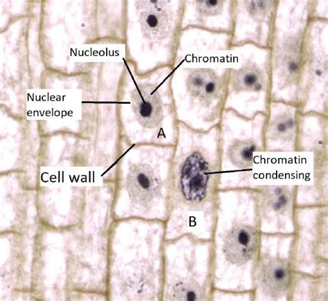 Onion Root Cell Mitosis Labeled - Juventu dugtleon