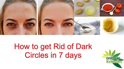 How To Remove Dark Circles Naturally In 7 Days 100 Results Aankhon