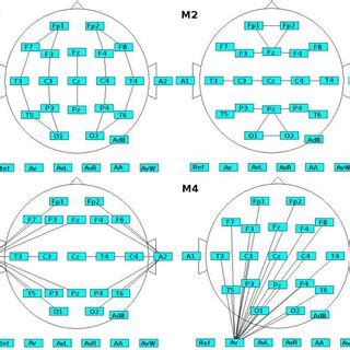 Maps Of EEG Power Spectra For Bandranges For Montage Monopolar And