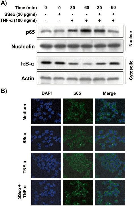 Inhibition Of Nf B Nuclear Translocation By Sseo In Tnf Stimulated