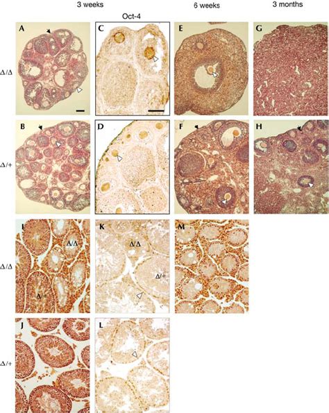 Oct4 Phenotype In Adult Gonads Immunostaining With Oct 4 Antibody