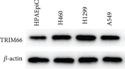 Trim Is Highly Expressed In Nsclc Cells A B Relative Expression