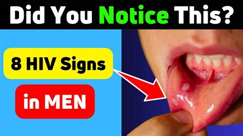 8 Signs Of Hiv In Men How Do You Know If A Guy Has Hiv Youtube