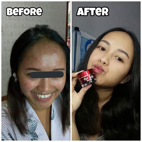 Skincareidn Beauty Base On Twitter Biu Pengalaman Pribadi Aku Pake