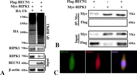 Becn1 Regulates Faddripk1caspase 8 Complex Formation Via Ripk1