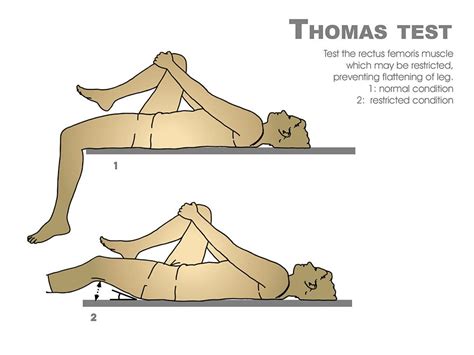 Labral Test Thomas Test Obus Test Online | www.changeyourwindows.com