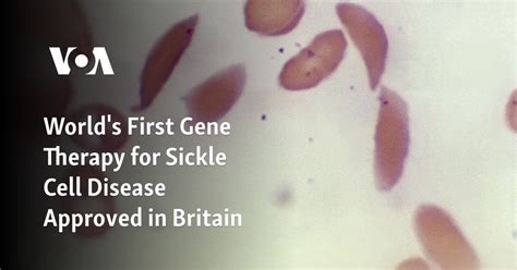 Worlds First Gene Therapy For Sickle Cell Disease Approved In Britain