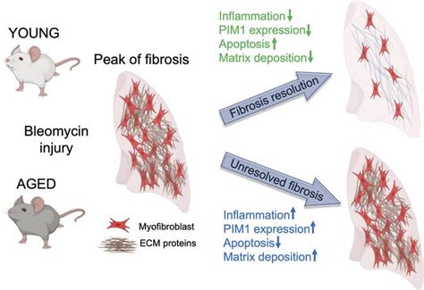 Jci Insight Transcriptional Analysis Of Lung Fibroblasts Identifies