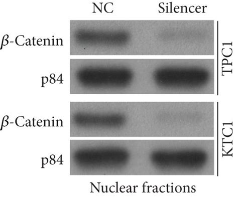 Depletion Of Loc N Inhibits The Wnt Catenin Signaling A