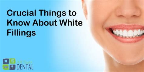 Crucial Things To Know About Dental White Fillings