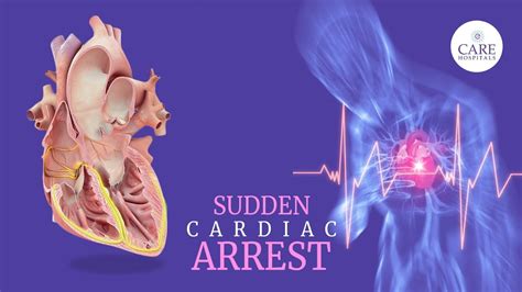 See What Happens During A Sudden Cardiac Arrest Symptoms Of Sudden