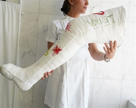 Long Leg Cast Plaster Cast With Toe Spica and Long Arm Cast / Medical ...