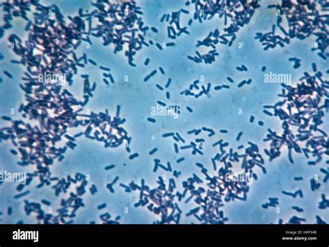 Salmonella enterica serotype typhimurium hi-res stock photography and ...