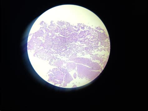 Histopathology Specimen In Hematoxylin And Eosin Stain With 10x