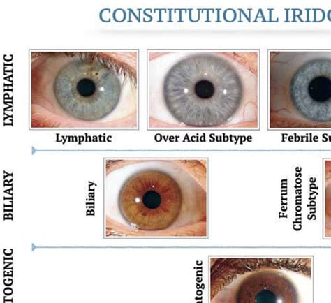 Iridology Chart Know Your Wellness