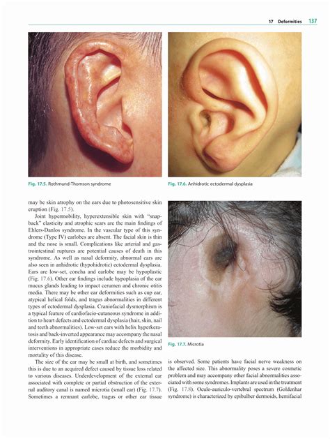 dermatological diseases - pictures, photos