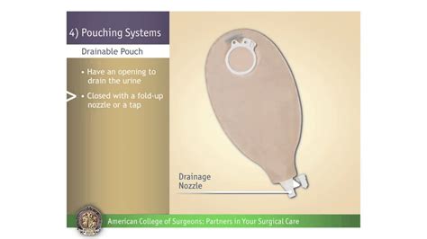 Pediatric Urostomy Pouching Systems Youtube