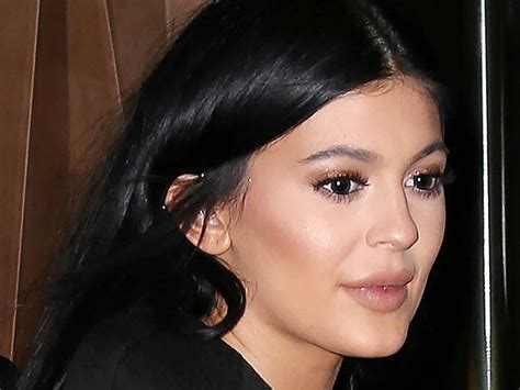 Kylie Jenner Lip Fillers Experts Explain The Medical And Ethical Minefield Around Injecting A