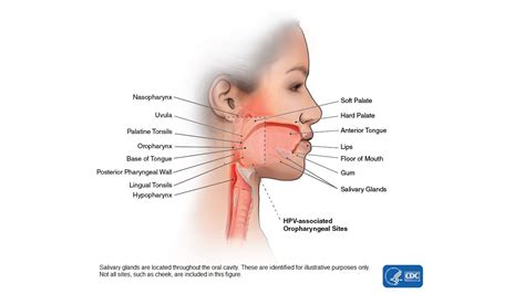 Head and Neck Cancers Basics | Head and Neck Cancers | CDC