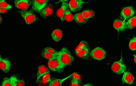 Neuroblastoma treatment