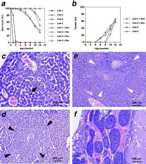 Expression Of Hmet In Mouse Hepatocytes Induces Hcc A And B Survival