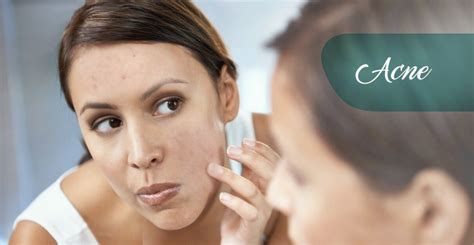 Tratamento De Acne Clínica Luciano Schutz