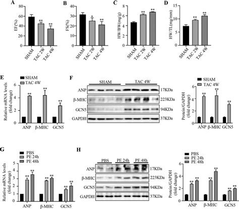 Gcn5 Expression Is Upregulated In Hypertrophic Mouse Hearts And