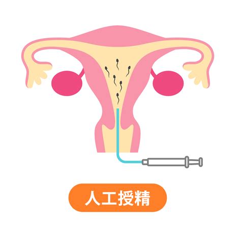 不妊治療の成功確率｜四条烏丸レディースクリニック