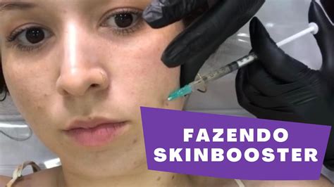 Como é O Skinbooster Da Botoclinic Youtube