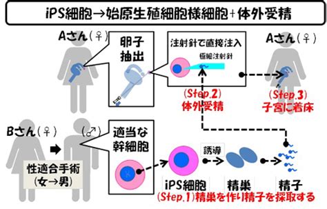 男性から女性に性転換した人は、赤ちゃんを産むことができるのか？ ビジネスジャーナル