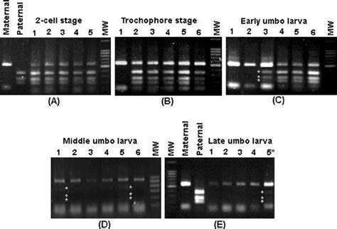 PCR RFLP Analysis Of Make Up Of The ITS Region In The Hybrid With