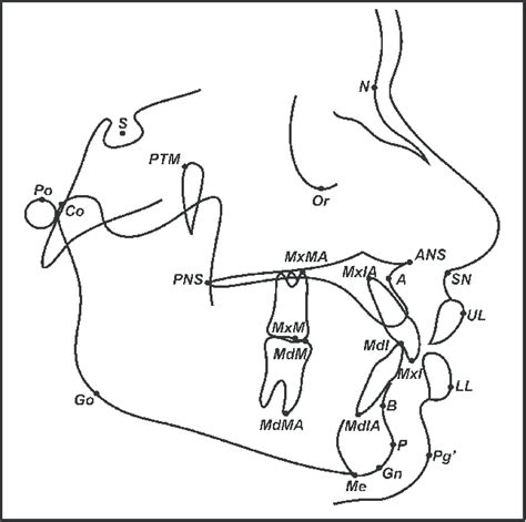 Lateral Cephalometric Landmarks S Sella N Nasion Or Orbitale Po