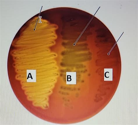 Solved A What Would You Score The Hemolysis For A B And C Chegg