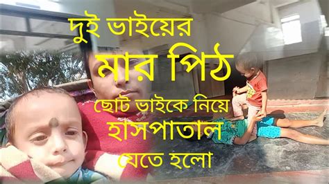 দুই ভাই আজকে খুব মারামারি করলো ছোট্ট ভাইকে নিয়ে হাসপাতাল যেতে হলো