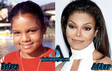 Janet Jackson Nose Job Before and After